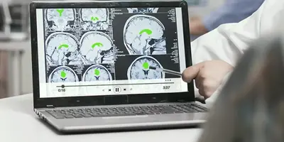 Generative AI in Healthcare: Improving Diagnosis and Patient Care