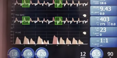 Evolva AI Impact on Healthcare